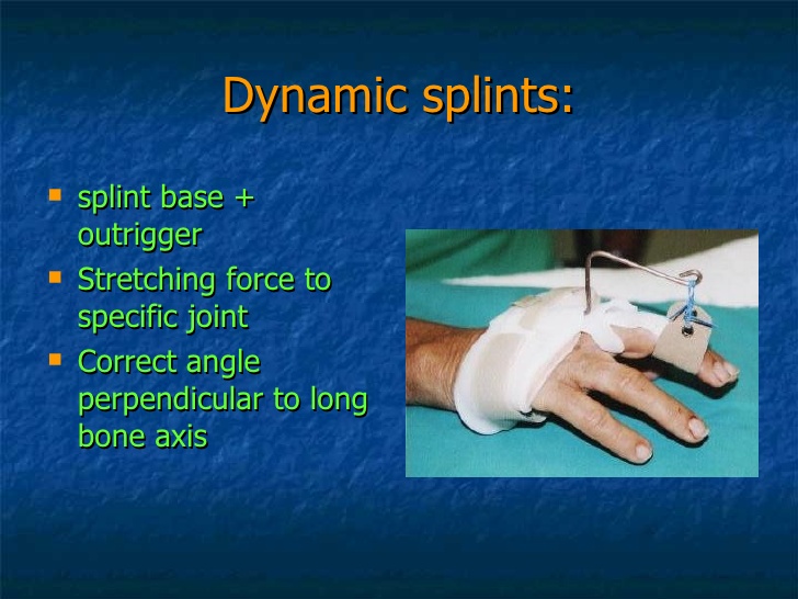 static vs dynamic splint